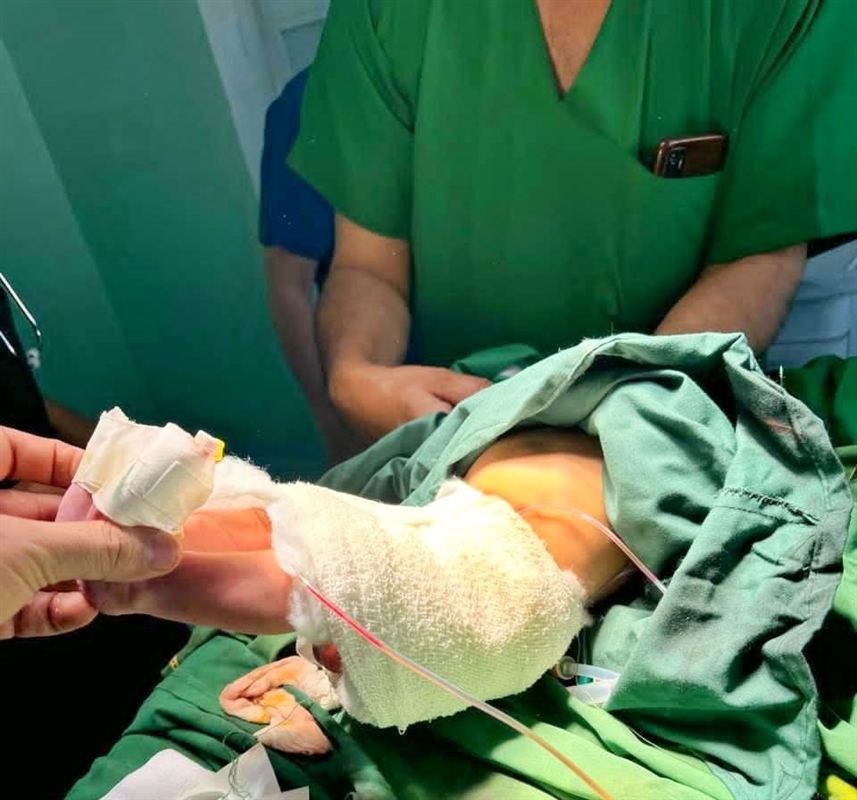 إنجاز طبي في تعز.. نجاح عملية نادرة لطفل حديث الولادة يعاني من تشوه خلقي