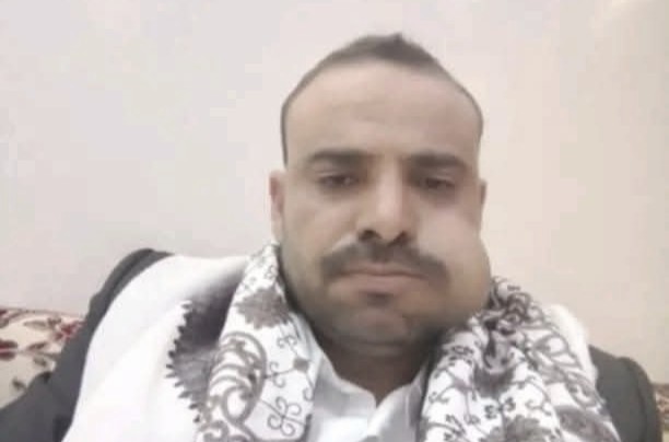 مليشيا الحوثي تغتال شيخًا قبليًا بارزًا في عمران وتُشعل توترًا قبليًا