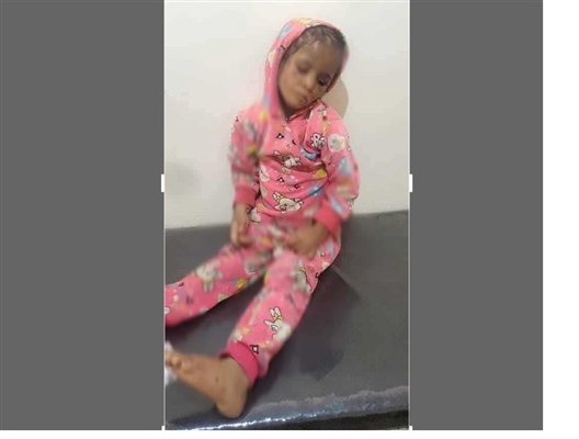 هل أفلت المعنّفون من العقاب؟ طفلة في الثامنة تتعرض لتعذيب وحشي بإب