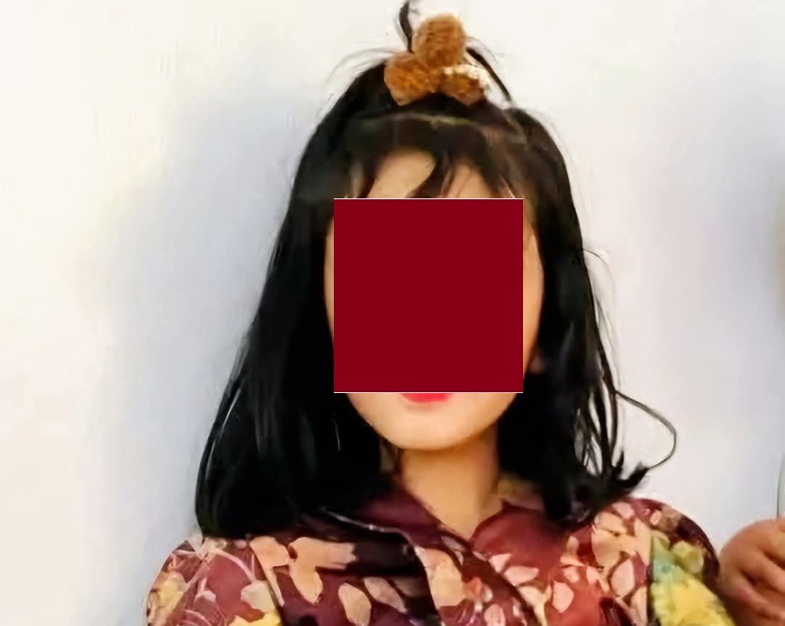 ضبط المتهمين بقتل الطفلة انهار العامري والقاء جثتها في بئر بمحافظة البيضاء