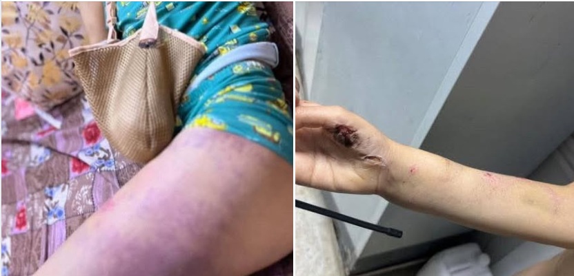 قيادي حوثي يختطف ويعذب طفلا في إب: جريمة تهز الرأي العام المحلي