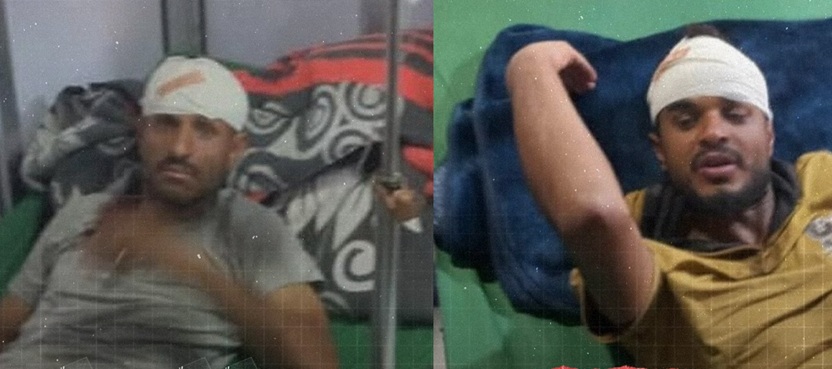 إصابة 4 أشخاص برصاص الحوثيين احتجوا على حرمانهم من العمل في أرضهم جنوب اليمن